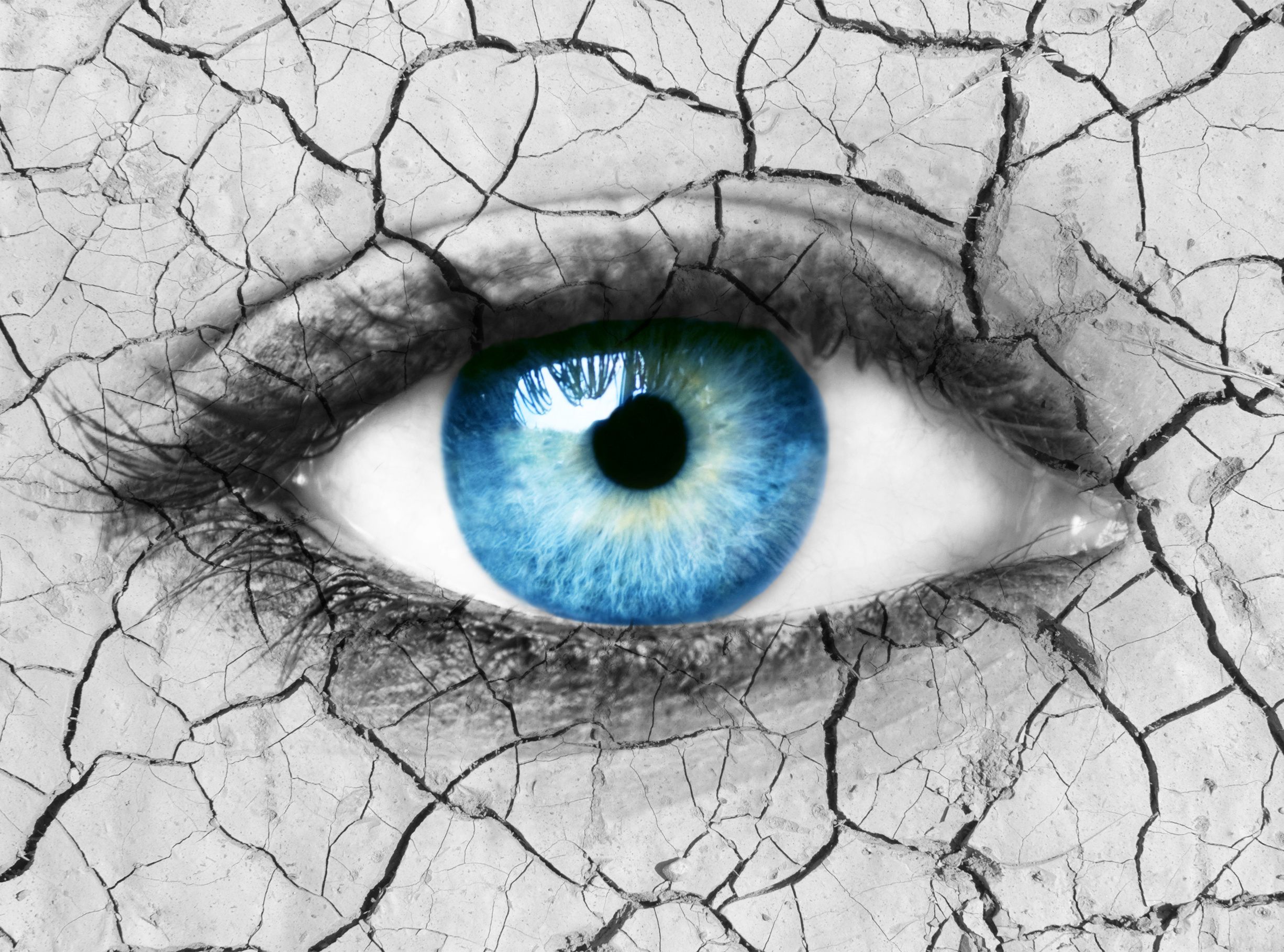 Trockene Augen